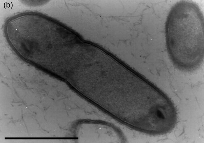 Caldicellulosiruptor hydrothermalis, ����������� �����������. ��������: Miroshnichenko et al., 2008, International Journal of Systematic and Evolutionary Microbiology.