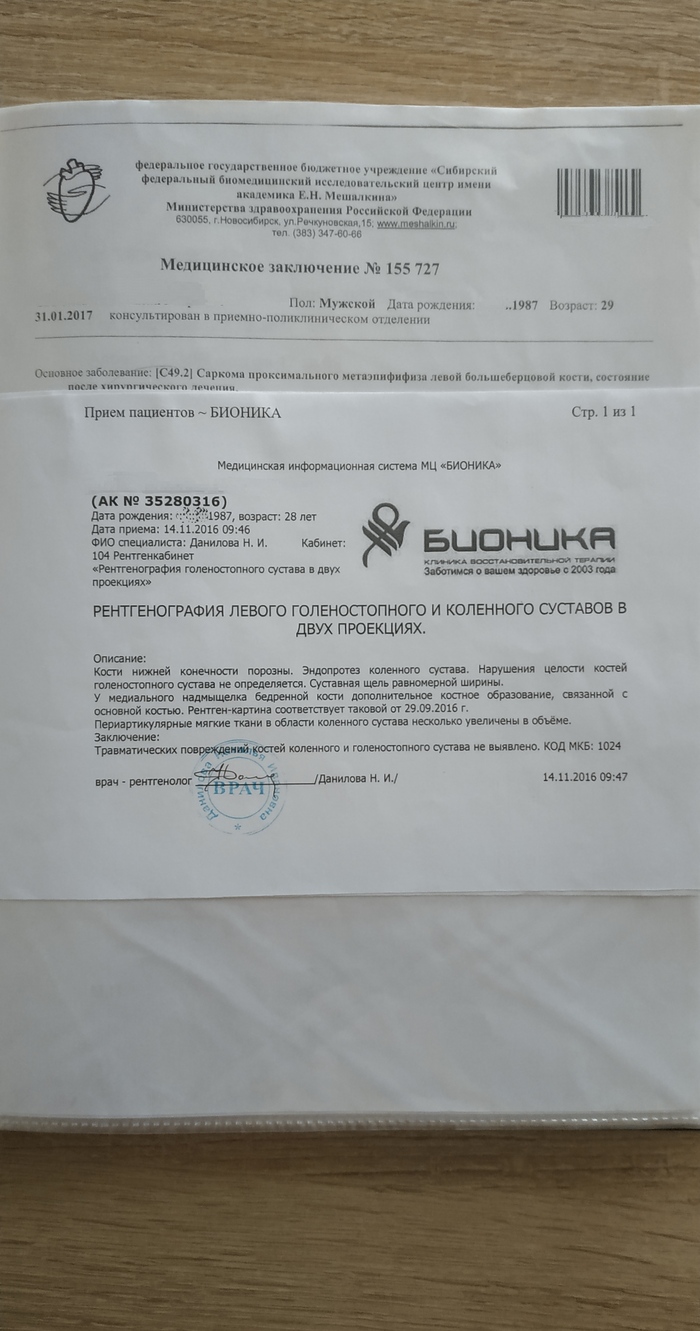 Всё в порядке, просто растяжение